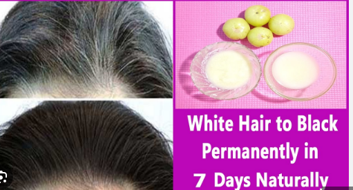 Get back your natural black beard & hair without dye, chemicals, or damage Black Hair | Sam's Serum for Men & Women | Helps Turn White Hair to Black (75 ml)