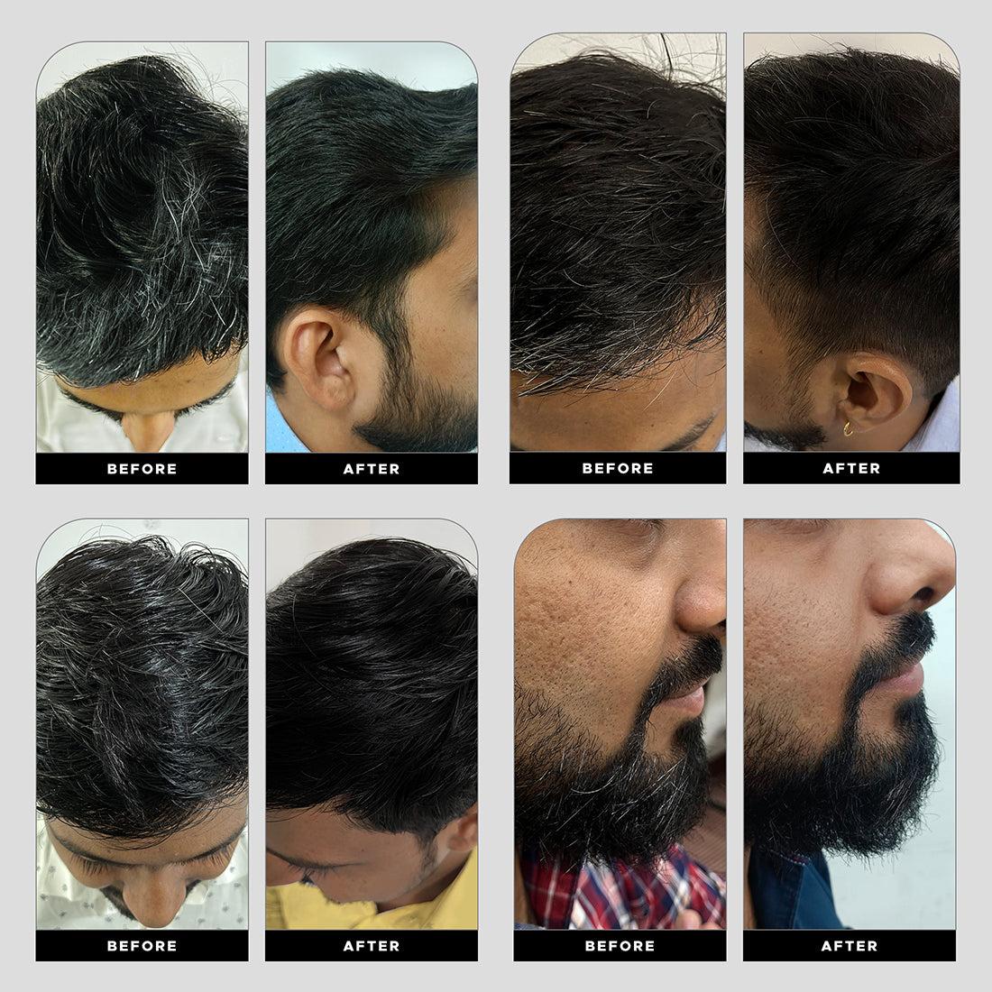 White Hair Protect Oil