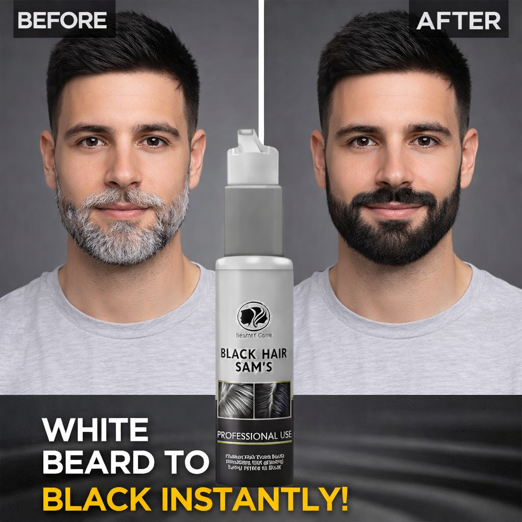 Get back your natural black beard & hair without dye, chemicals, or damage Black Hair | Sam's Serum for Men & Women | Helps Turn White Hair to Black (75 ml)