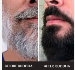 Get back your natural black beard & hair without dye, chemicals, or damage Black Hair | Sam's Serum for Men & Women | Helps Turn White Hair to Black (75 ml)